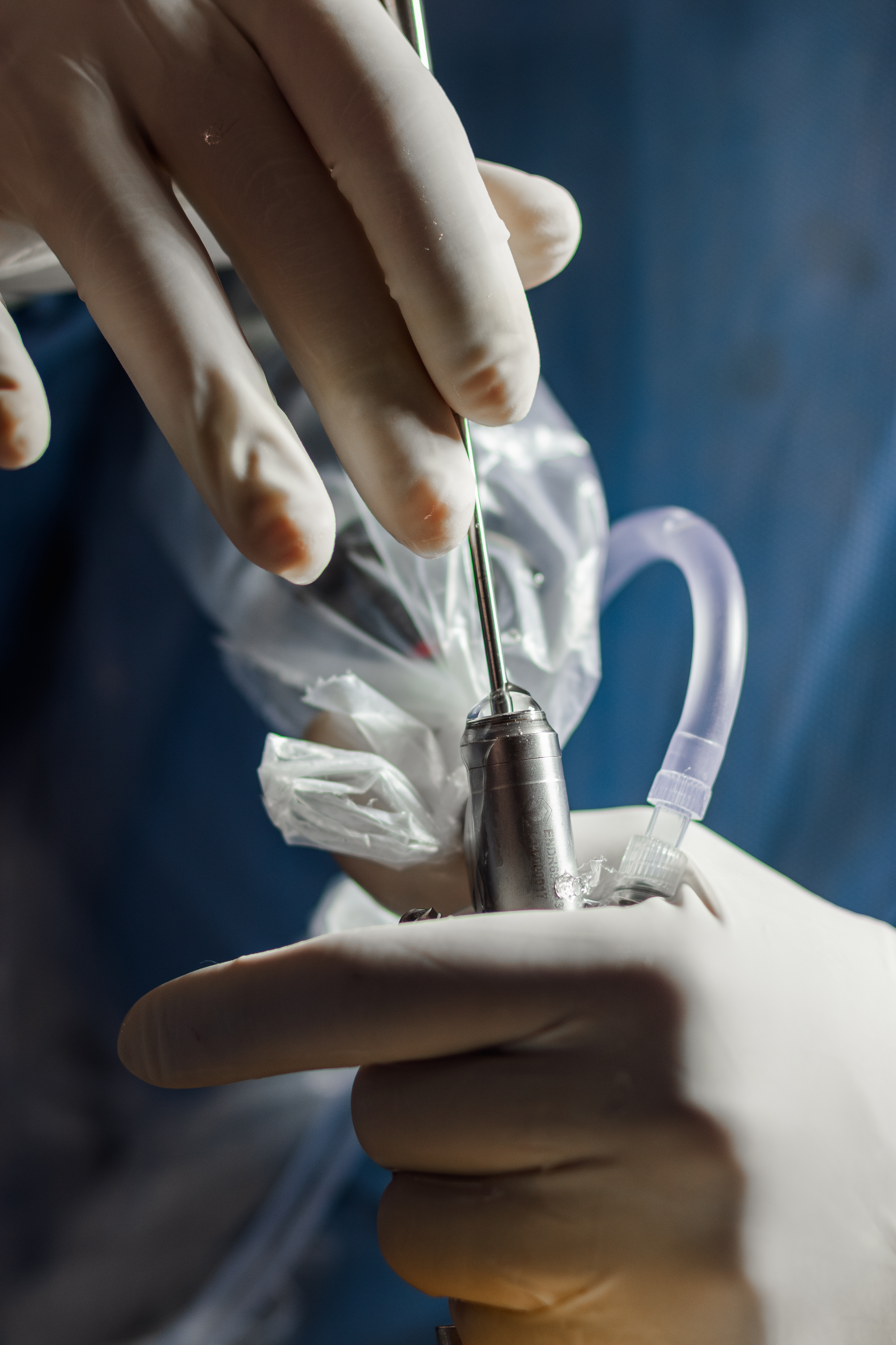 Anatomia da Coluna Vertebral 3D